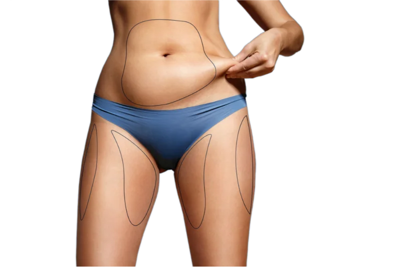 Body Contouring