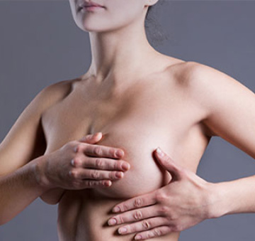 Breast Reduction