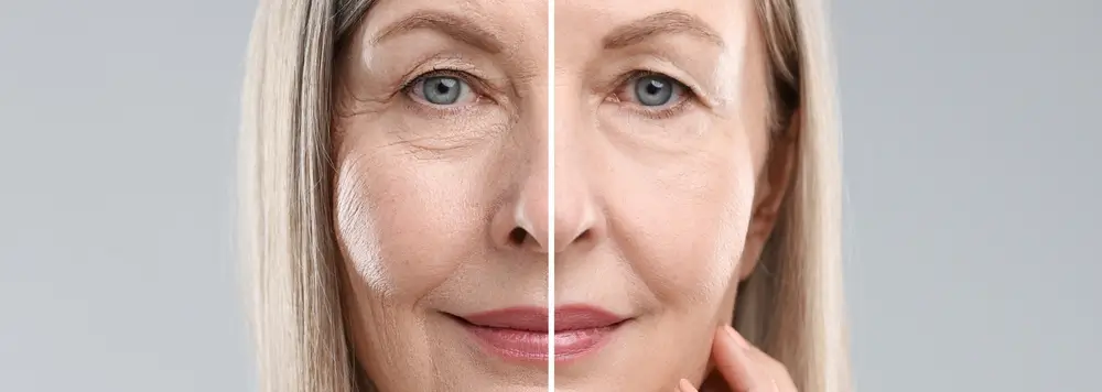 Summer Confidence Starts Here: A Guide to Body Contouring and Facial Rejuvenation in Durham, NC